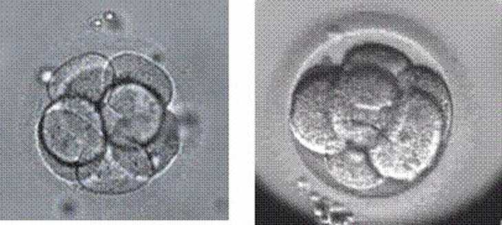 男性不孕症[新时代试管辅助]+西安姐妹试管婴儿科普|独家揭秘胚胎「选美」的